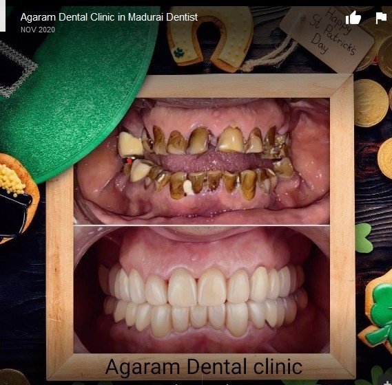 Agaram Dental Clinic - Agaram Dental Clinic