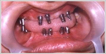 عيادة أغاروال لطب الأسنان كابورثالا - Aggarwal Dental Clinic Kapurthala
