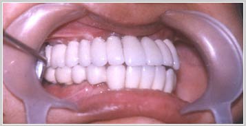 عيادة أغاروال لطب الأسنان كابورثالا - Aggarwal Dental Clinic Kapurthala