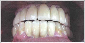 عيادة أغاروال لطب الأسنان كابورثالا - Aggarwal Dental Clinic Kapurthala