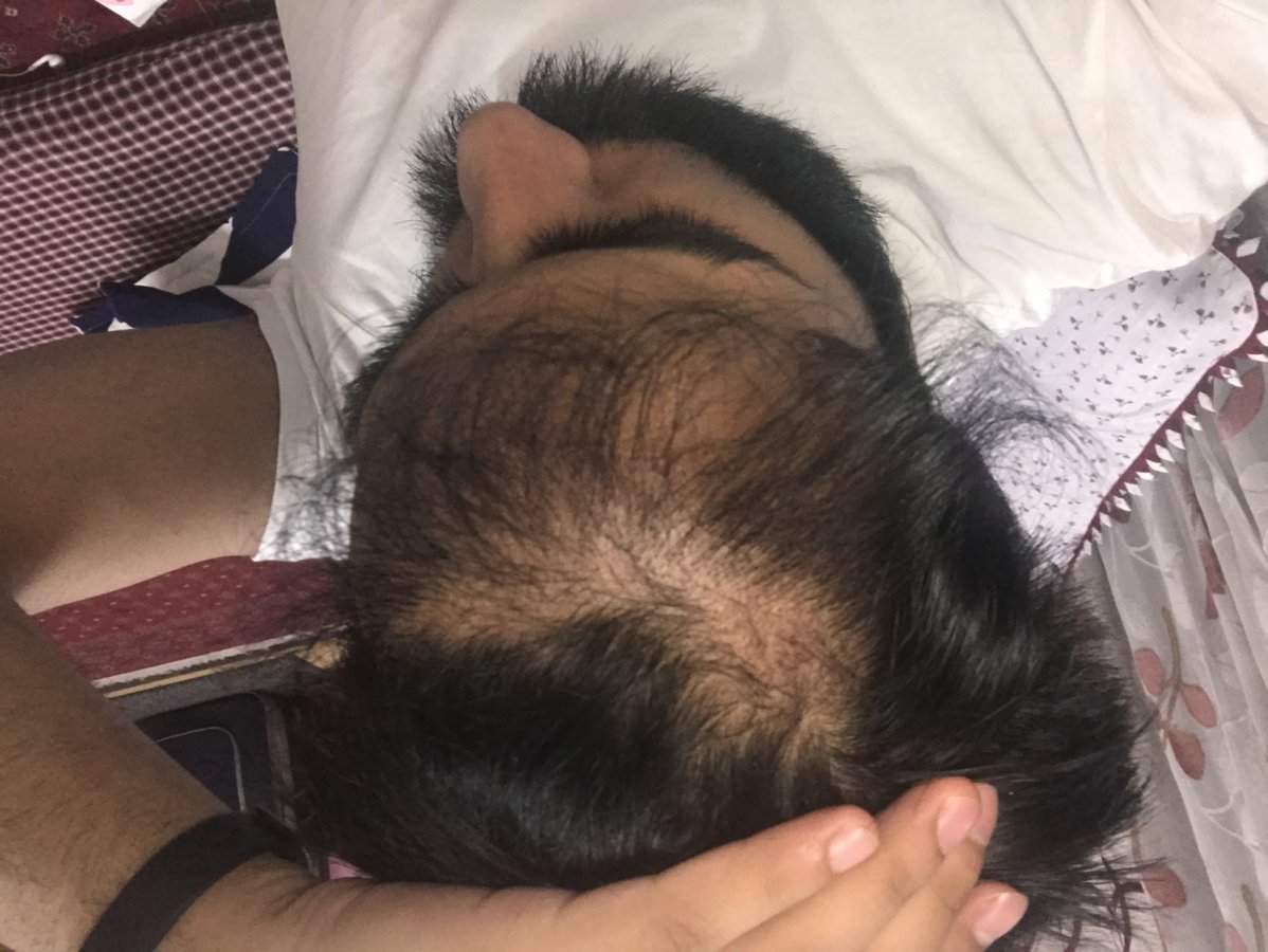 AKESO Hair Transplant and Plastic Surgery - AKESO Hair Transplant and Plastic Surgery