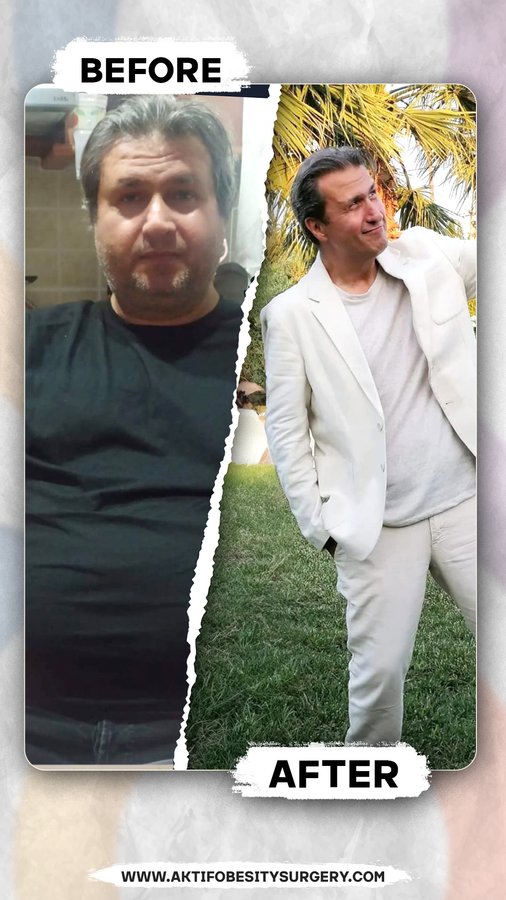 Aktif International Hospitals - Obesity - Aktif International Hospitals - Obesity