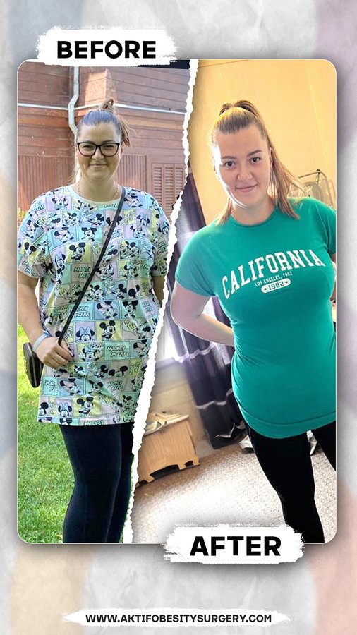 Aktif International Hospitals - Obesity - Aktif International Hospitals - Obesity