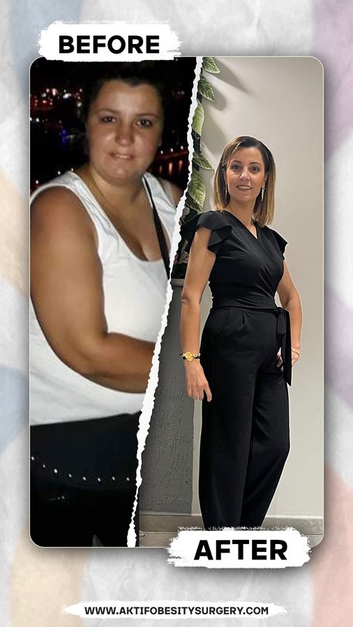 Aktif International Hospitals - Obesity - Aktif International Hospitals - Obesity