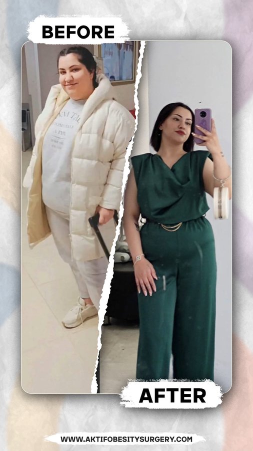 Aktif International Hospitals - Obesity - Aktif International Hospitals - Obesity