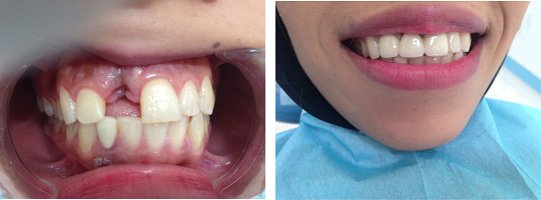 مركز المراج متعدد التخصصات لطب الأسنان - Al Meraj Multispeciality Dental Centre