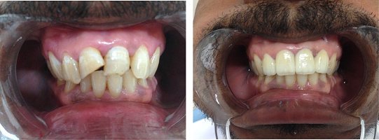 مركز المراج متعدد التخصصات لطب الأسنان - Al Meraj Multispeciality Dental Centre