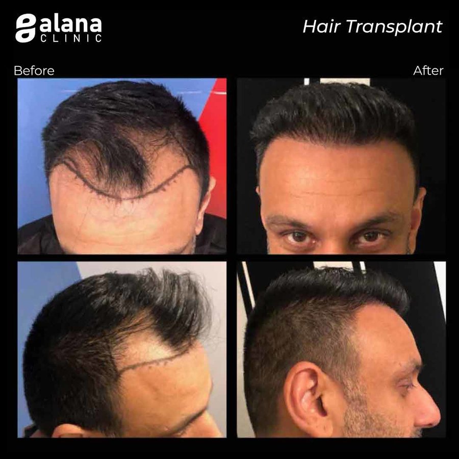 Alana Clinic - Alana Clinic