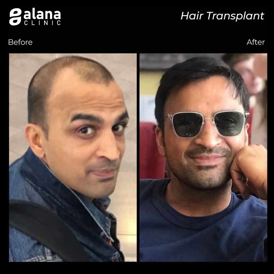 Alana Clinic - Alana Clinic