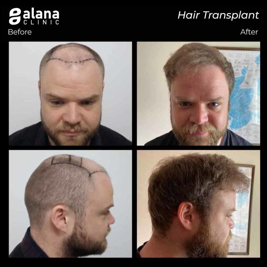 Alana Clinic - Alana Clinic