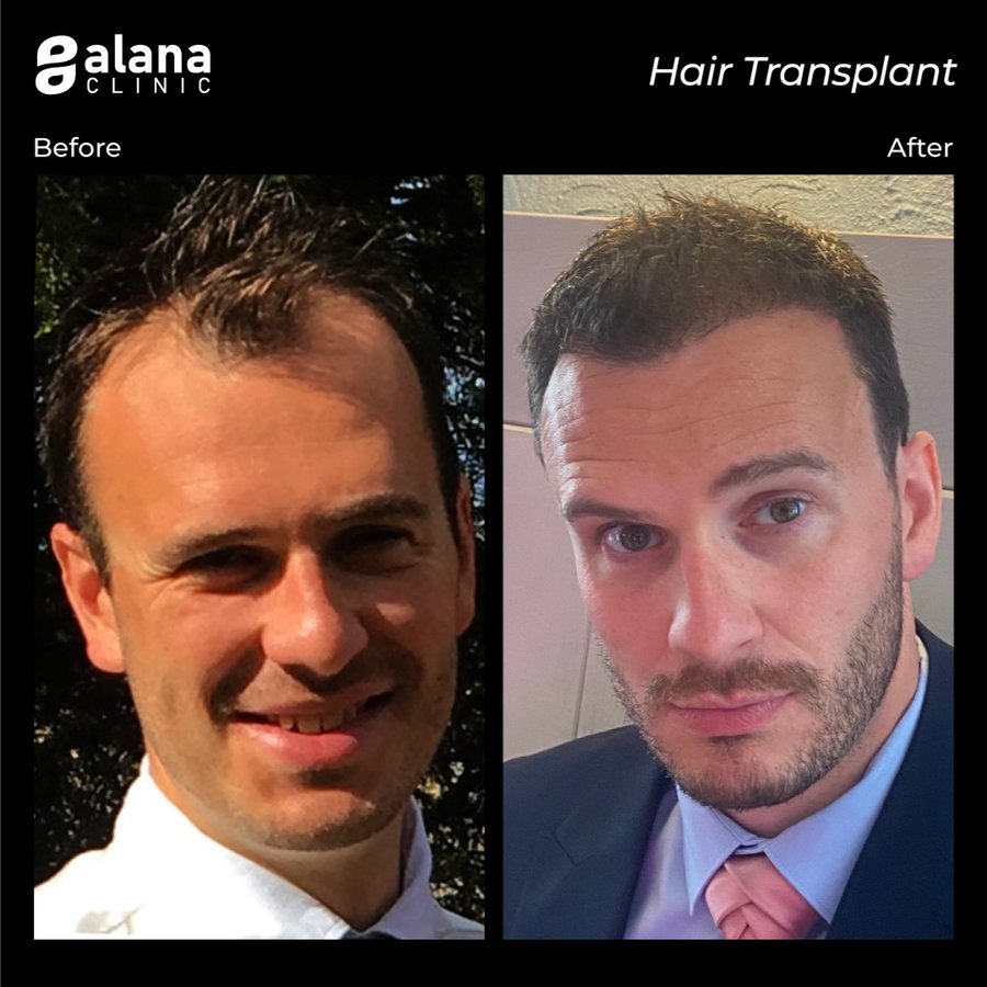 Alana Clinic - Alana Clinic