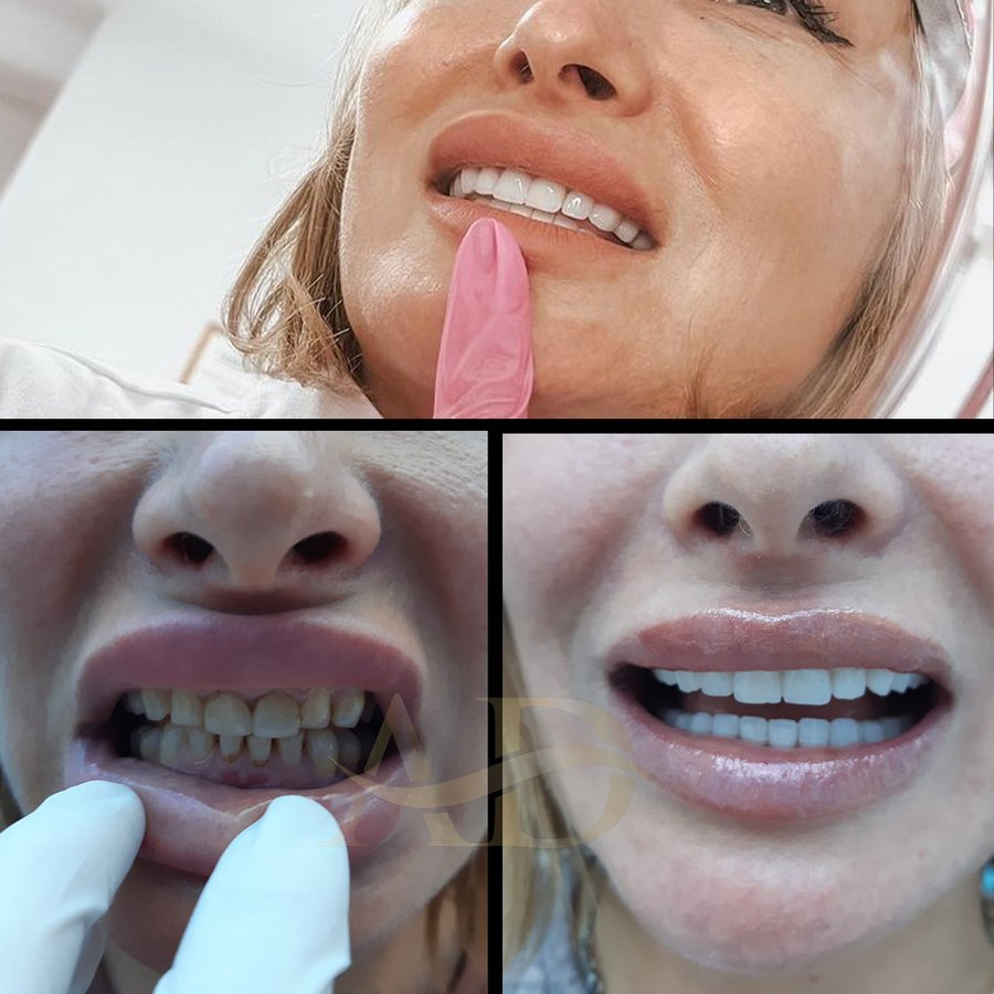 Alanya Dental Place - Alanya Dental Place