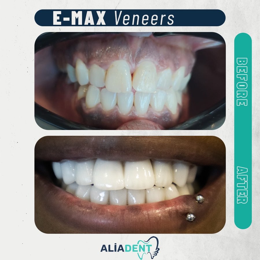 Aliadent Dental Health Clinic - Sultanbeyli - Aliadent Dental Health Clinic - Sultanbeyli