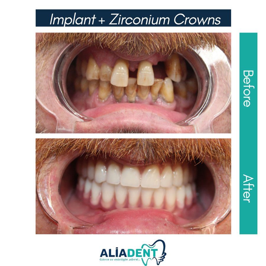 Aliadent Dental Health Clinic - Sultanbeyli - Aliadent Dental Health Clinic - Sultanbeyli