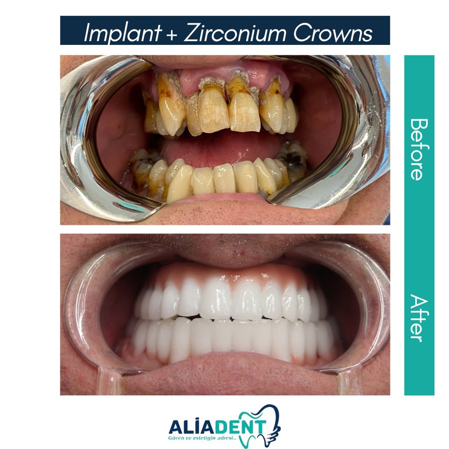 Aliadent Dental Health Clinic - Sultanbeyli - Aliadent Dental Health Clinic - Sultanbeyli