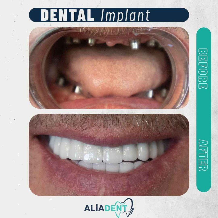 Aliadent Dental Health Clinic - Sultanbeyli - Aliadent Dental Health Clinic - Sultanbeyli