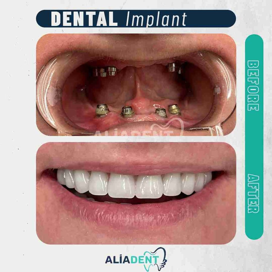 Aliadent Dental Health Clinic - Sultanbeyli - Aliadent Dental Health Clinic - Sultanbeyli