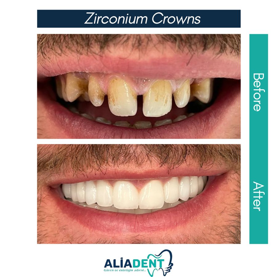 Aliadent Dental Health Clinic - Sultanbeyli - Aliadent Dental Health Clinic - Sultanbeyli