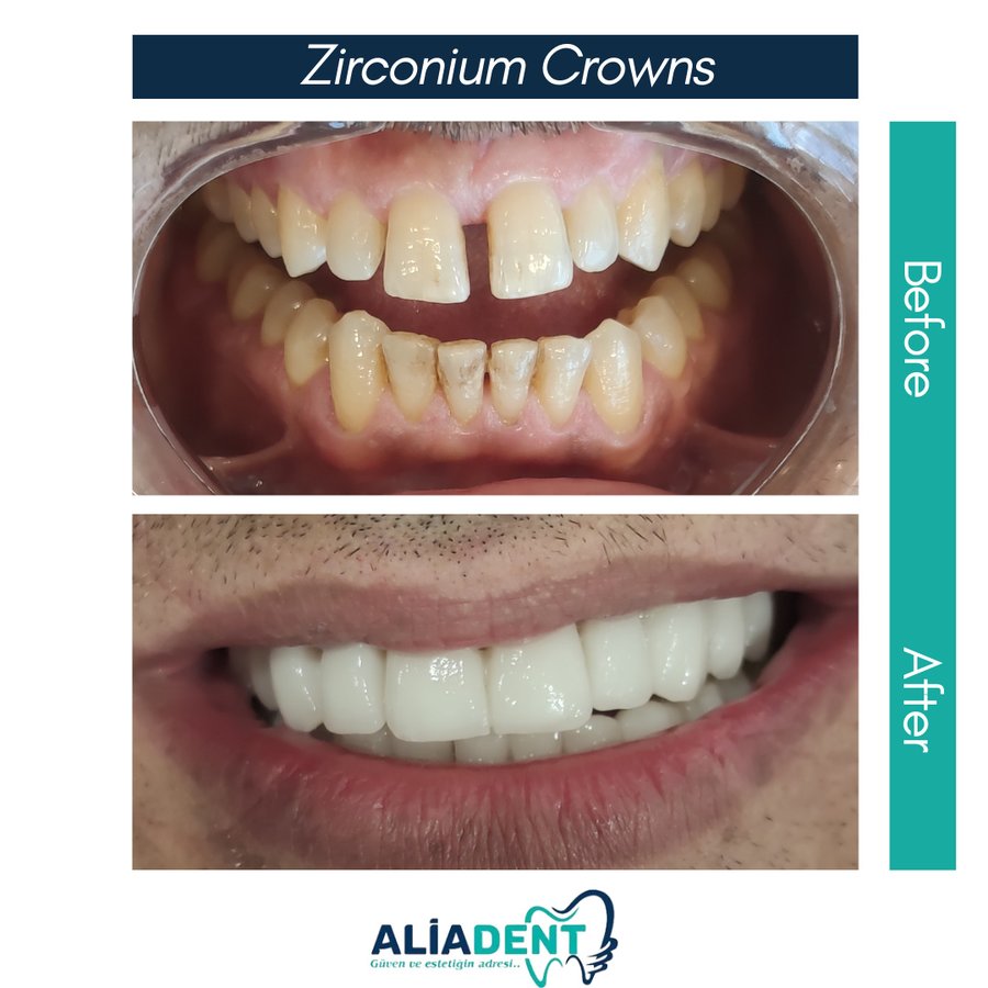 Aliadent Dental Health Clinic - Sultanbeyli - Aliadent Dental Health Clinic - Sultanbeyli