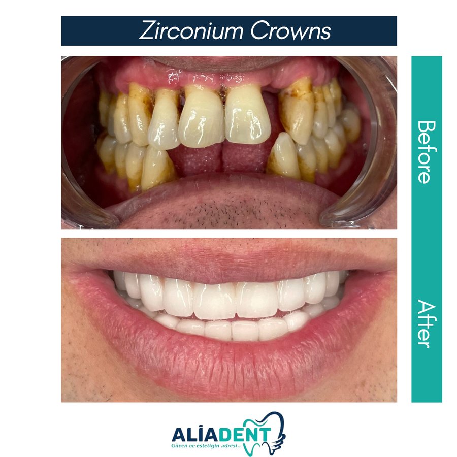 Aliadent Dental Health Clinic - Sultanbeyli - Aliadent Dental Health Clinic - Sultanbeyli