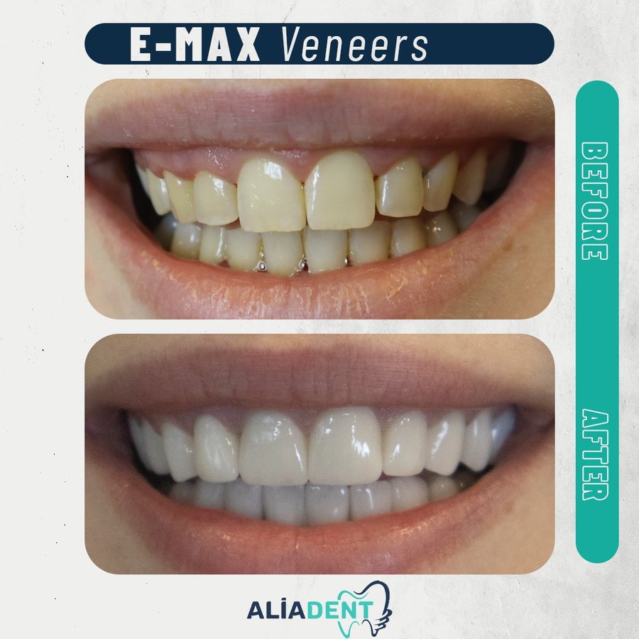 Aliadent Dental Health Clinic - Sultanbeyli - Aliadent Dental Health Clinic - Sultanbeyli