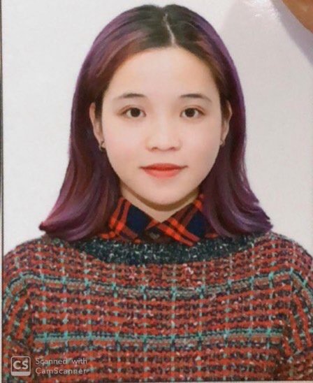 All On 4 Vietnam - The East Rose Dental - All On 4 Vietnam - The East Rose Dental