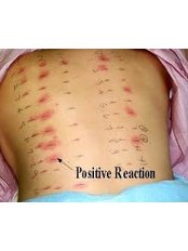 Allergy & ENT Diagnostics - Allergy & ENT Diagnostics