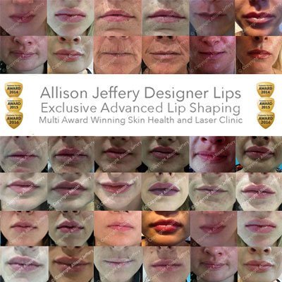 Allison Jeffery Skin Health and Laser Clinic - Allison Jeffery Skin Health and Laser Clinic