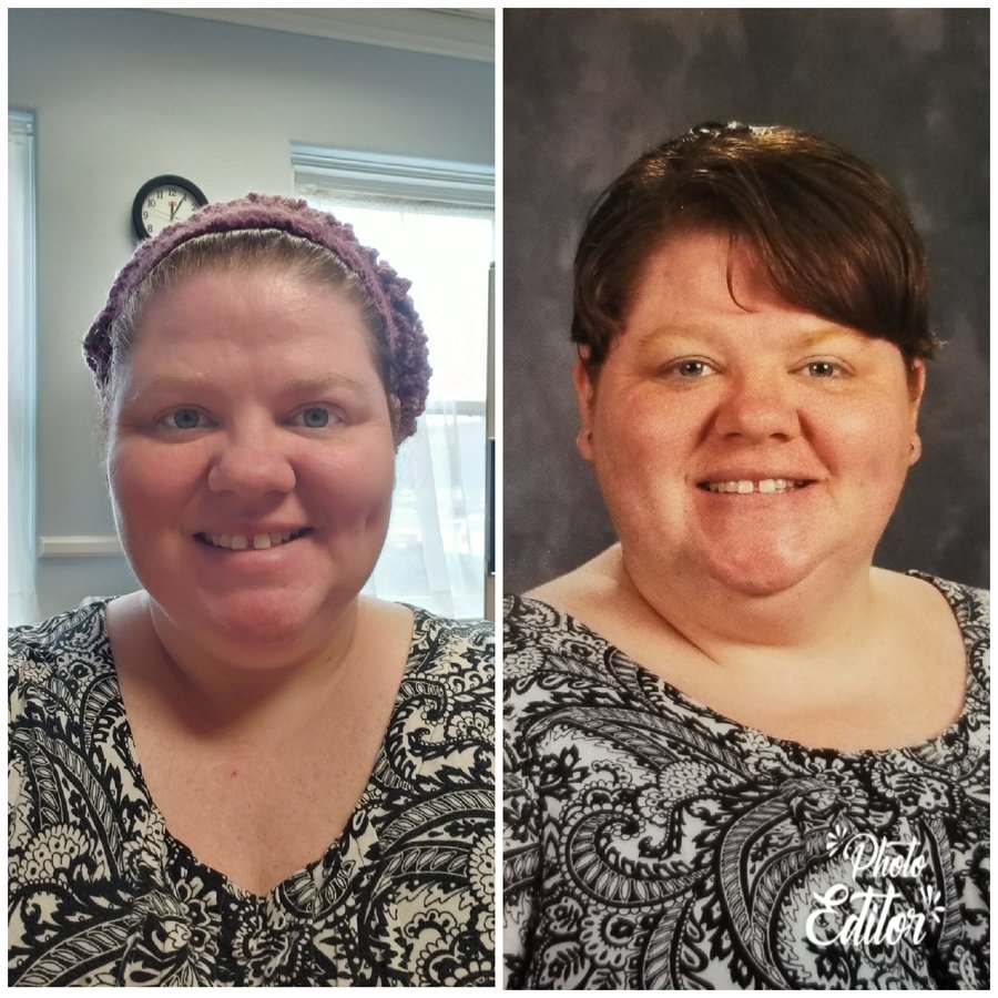 ALO Bariatrics - ALO Bariatrics