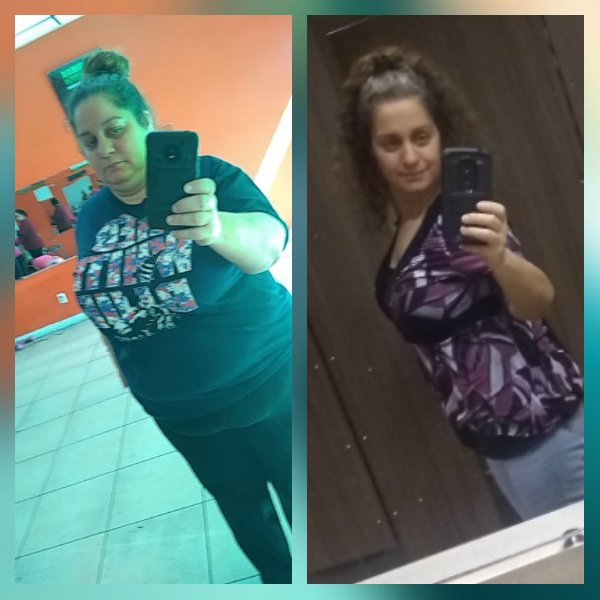 ALO Bariatrics - ALO Bariatrics