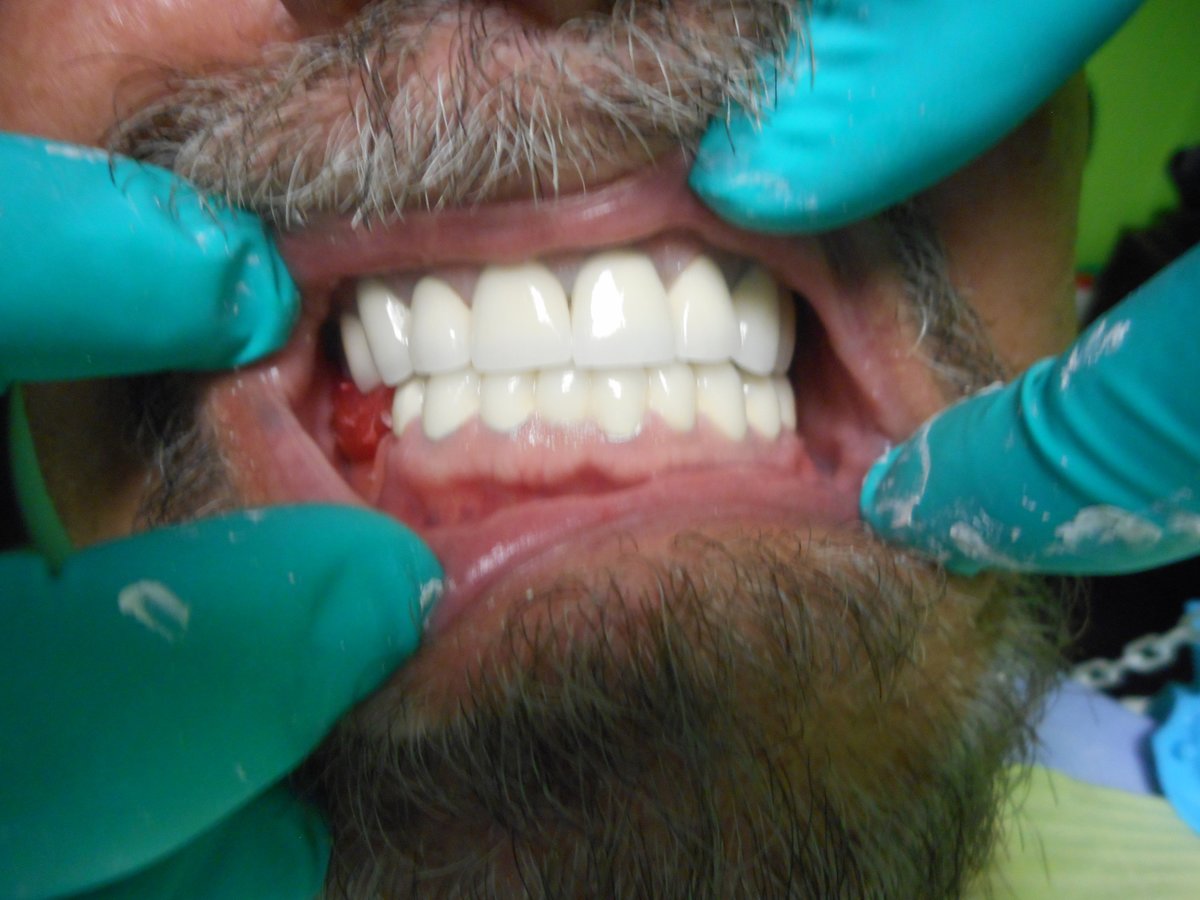 Alpha Dental Implant Center - Alpha Dental Implant Center