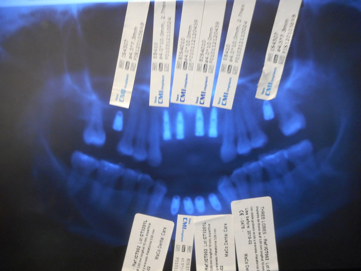 Alpha Dental Implant Center - Alpha Dental Implant Center