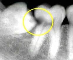 Alpha Dental Implant Center - Alpha Dental Implant Center