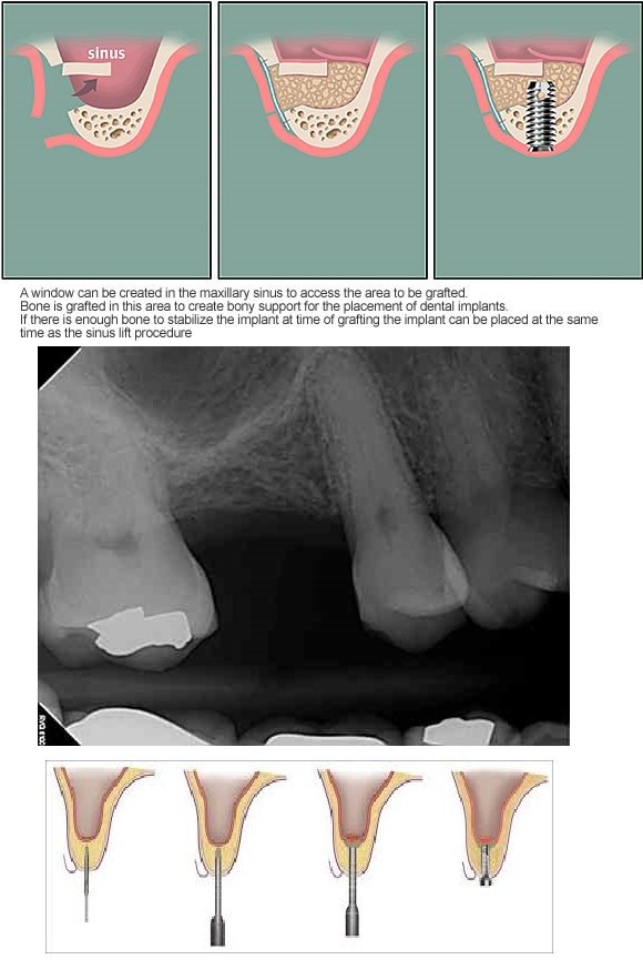 Alpha Dental Implant Center - Alpha Dental Implant Center