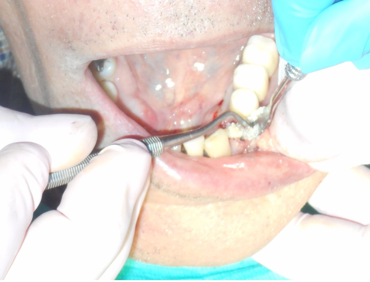 Alpha Dental Implant Center - Alpha Dental Implant Center