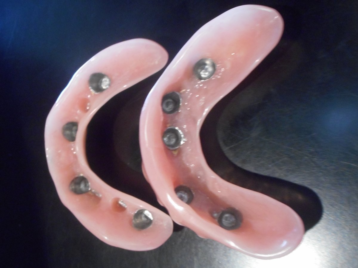 Alpha Dental Implant Center - Alpha Dental Implant Center