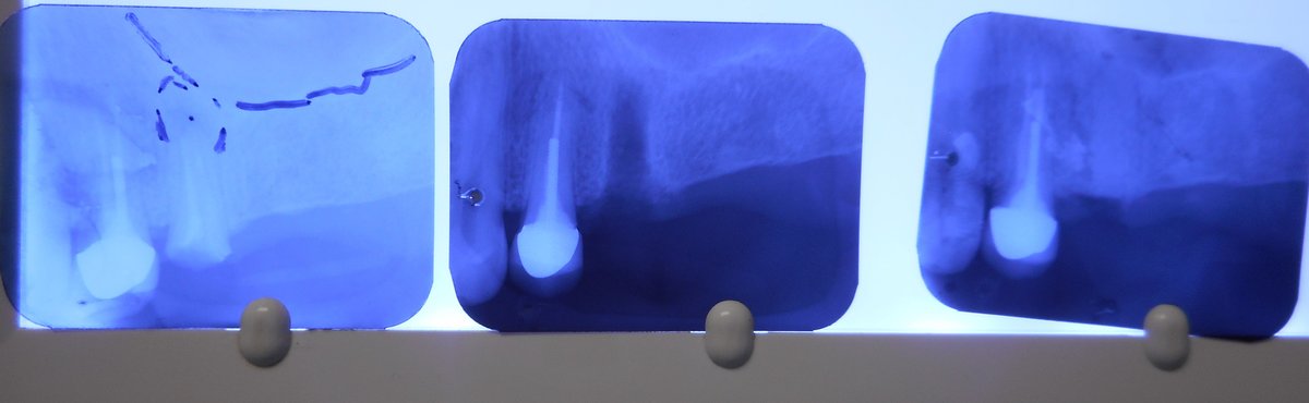 Alpha Dental Implant Center - Alpha Dental Implant Center