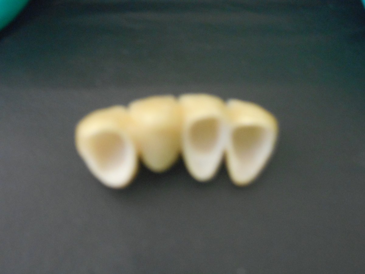 Alpha Dental Implant Center - Alpha Dental Implant Center