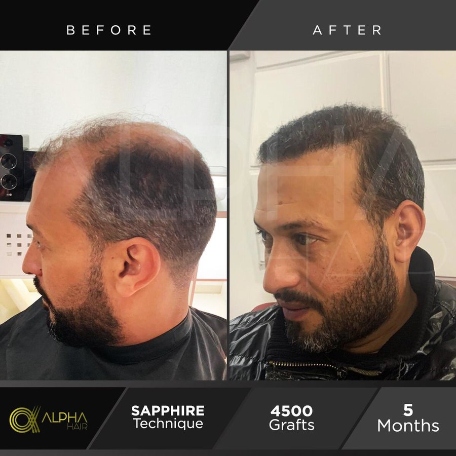 Alpha Hair Central - Alpha Hair Central