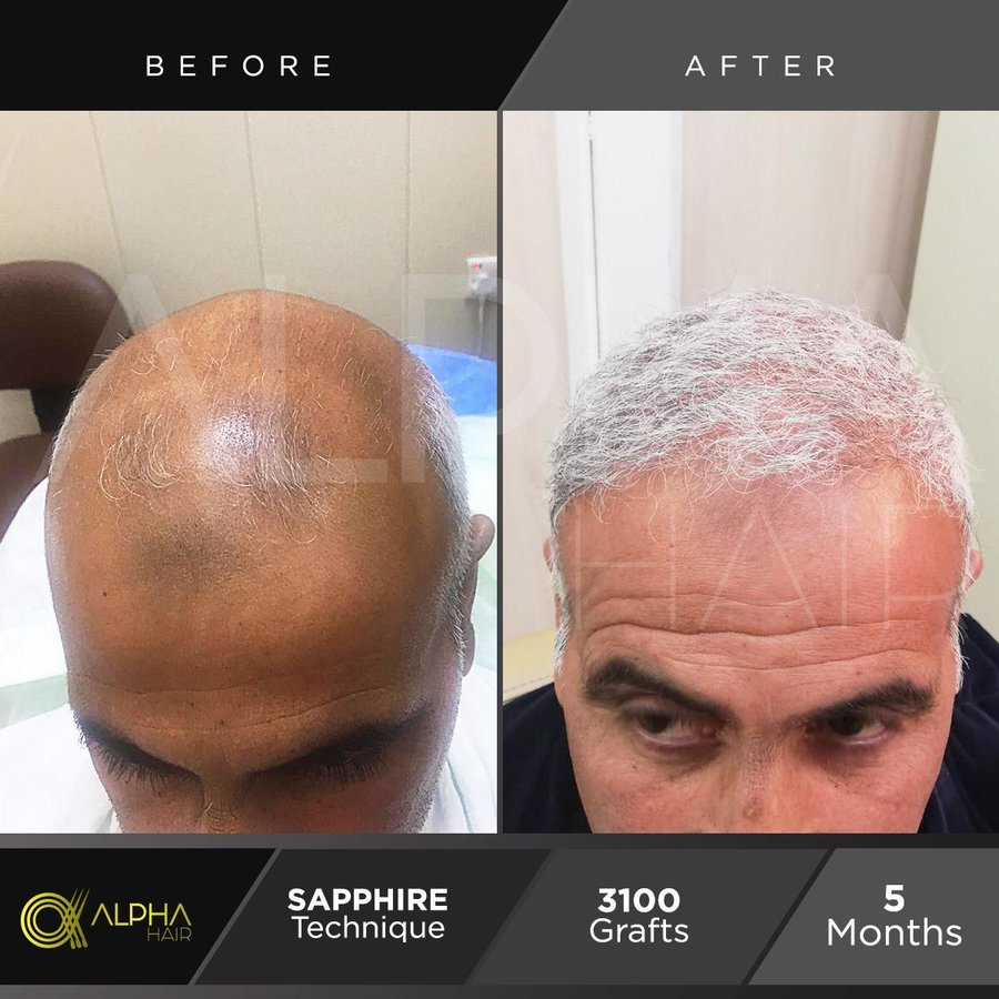 Alpha Hair Central - Alpha Hair Central