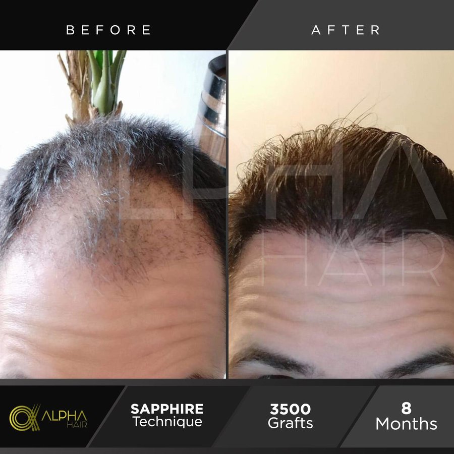 Alpha Hair Central - Alpha Hair Central