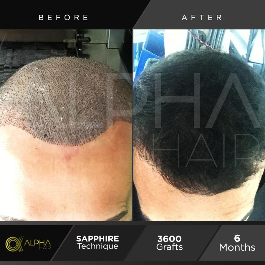Alpha Hair Central - Alpha Hair Central