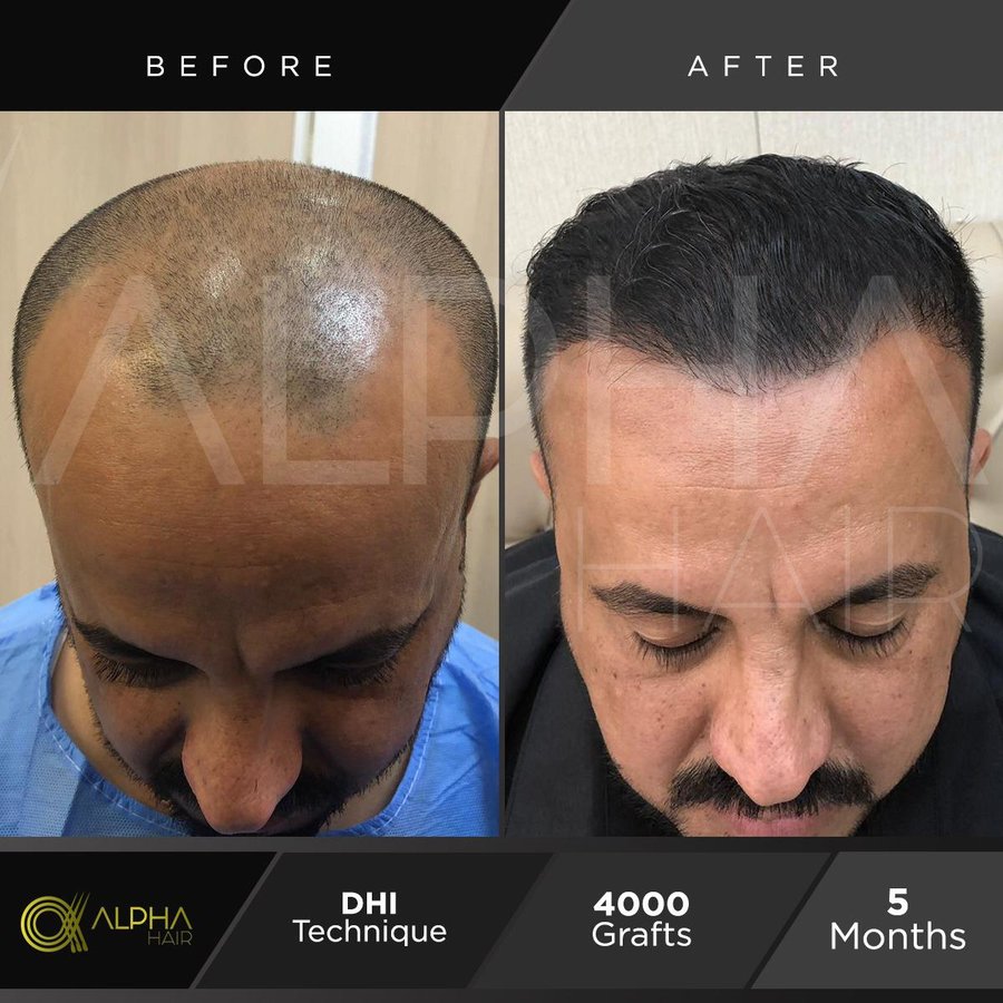 Alpha Hair Central - Alpha Hair Central