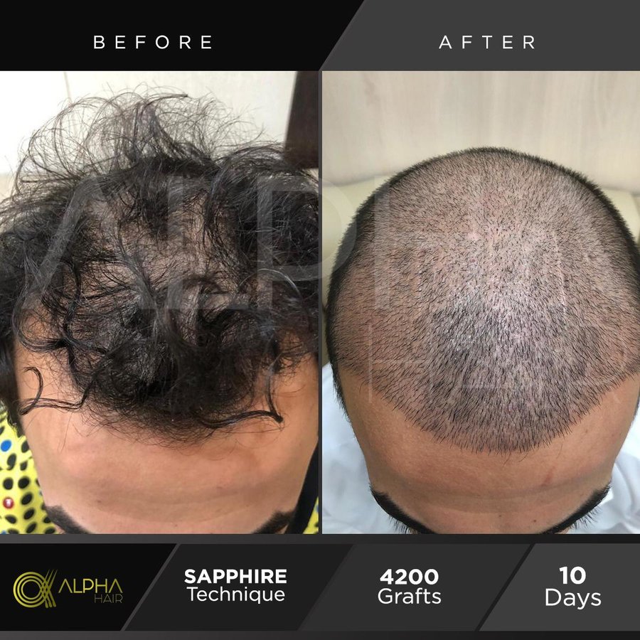 Alpha Hair Central - Alpha Hair Central