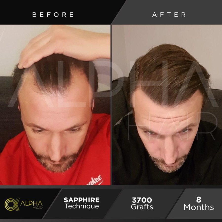 Alpha Hair Central - Alpha Hair Central