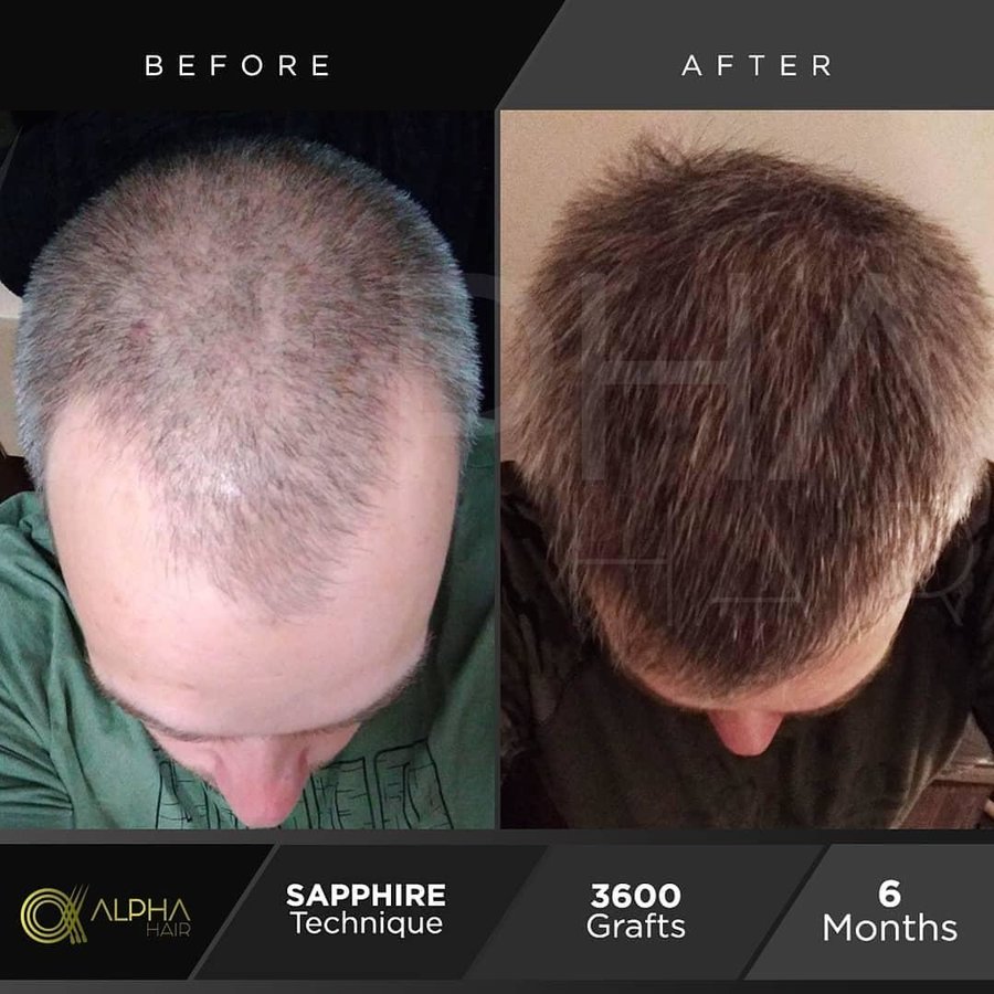 Alpha Hair Central - Alpha Hair Central
