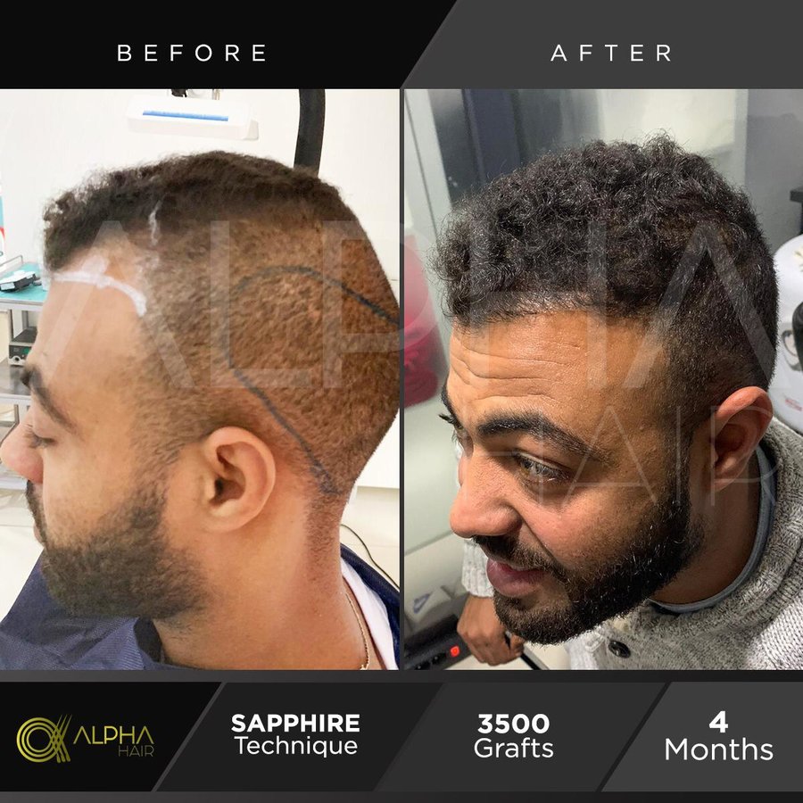 Alpha Hair Central - Alpha Hair Central