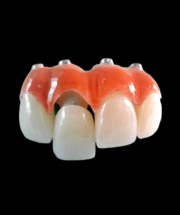 ألوكس لطب الأسنان - Alux Dental