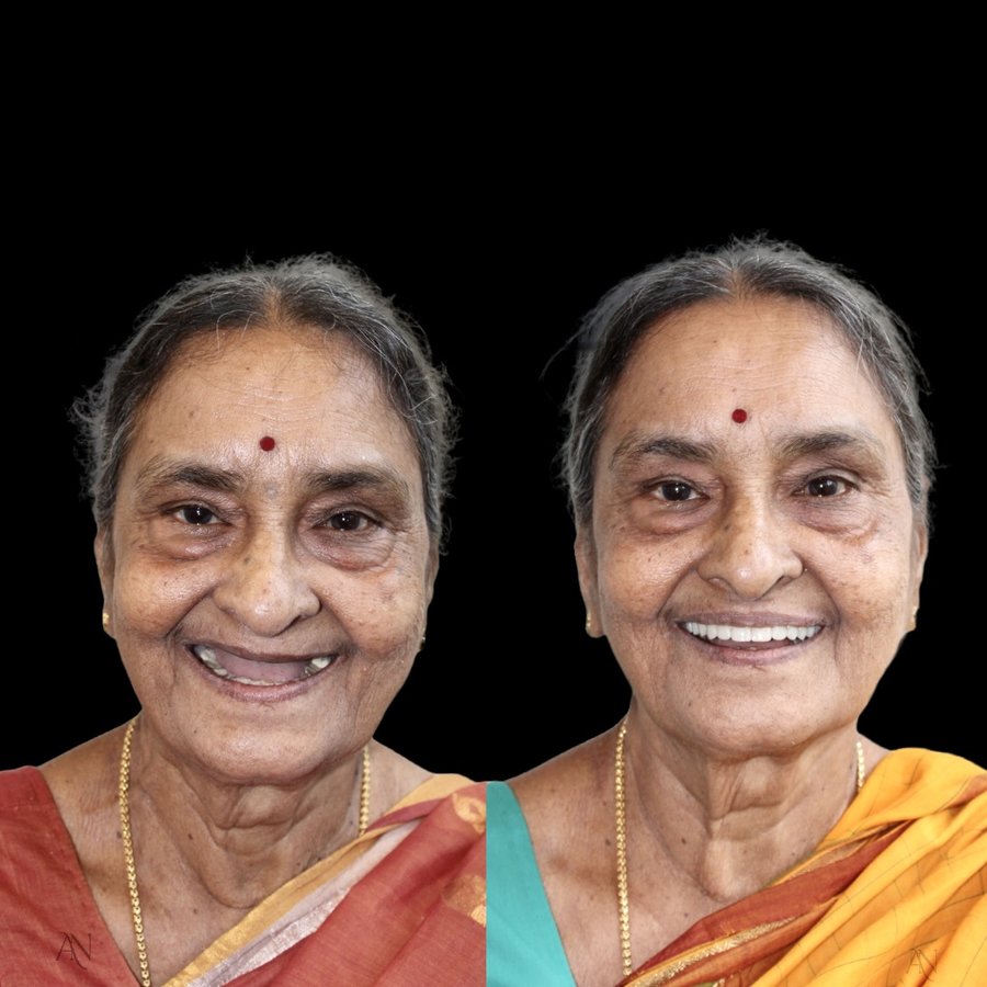 ألوكس لطب الأسنان - Alux Dental