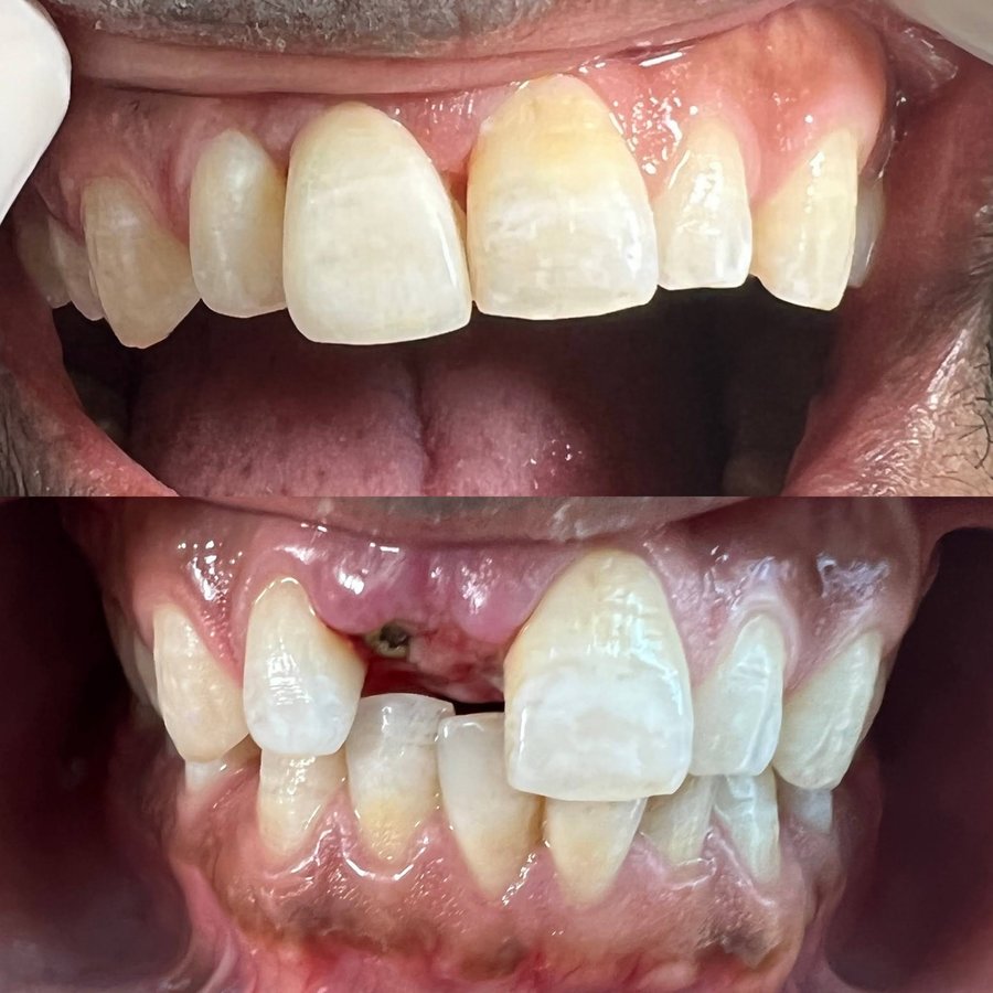 ألوكس لطب الأسنان - Alux Dental